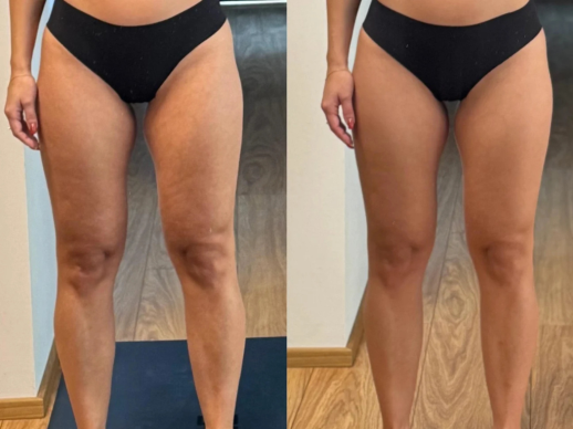 Vidite�n� zmena v�aka Re�tart v�zve: Tak�to v�sledky dok�e prinies� u� prv� t��de�